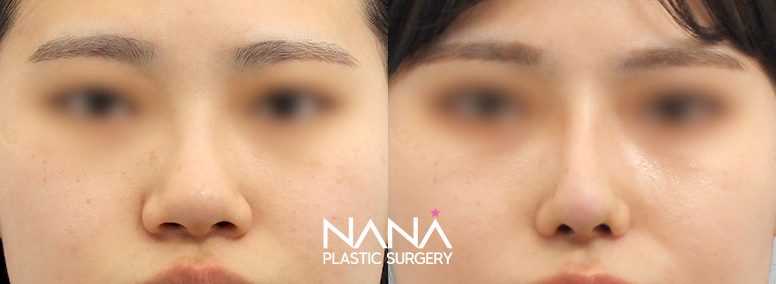 Before & After Before & After