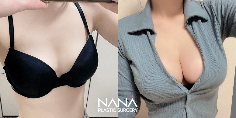 Before & After Before & After