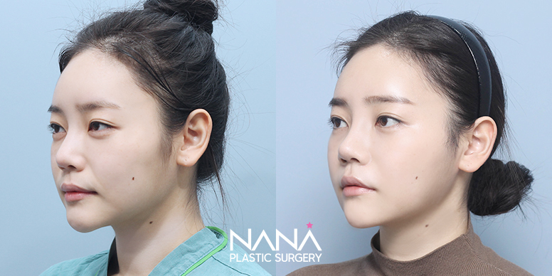 Before & After Before & After
