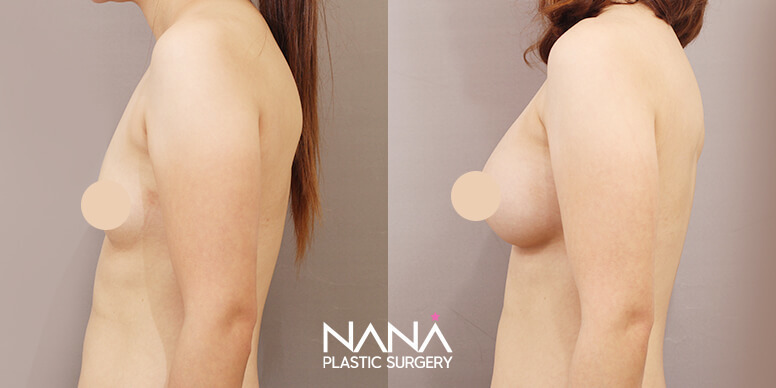 Before & After Before & After