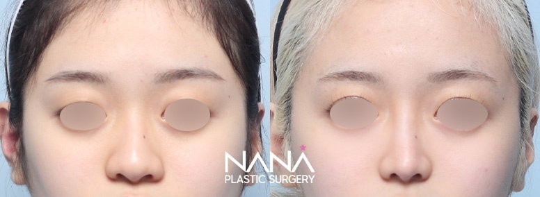 Before & After Before & After