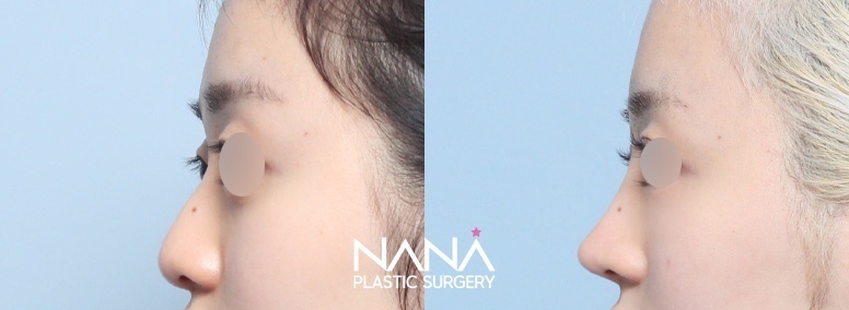 Before & After Before & After