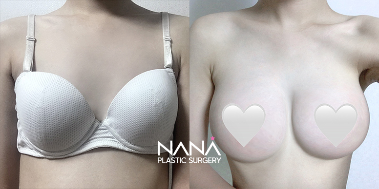Before & After Before & After