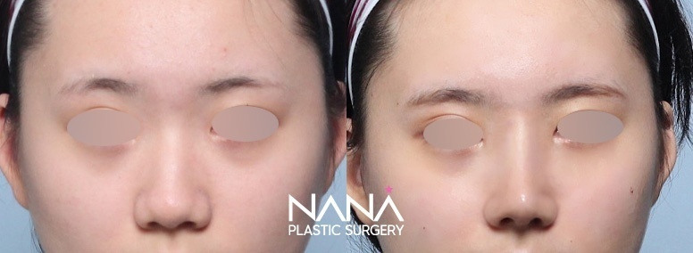 Before & After Before & After