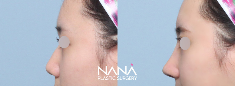 Before & After Before & After
