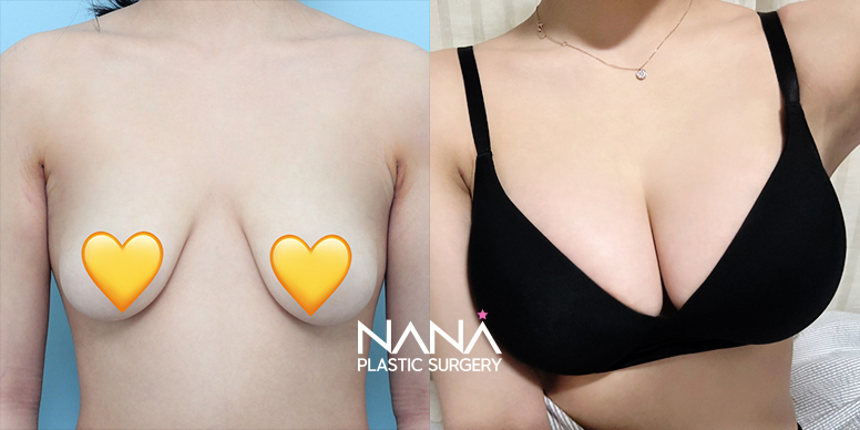 Before & After Before & After