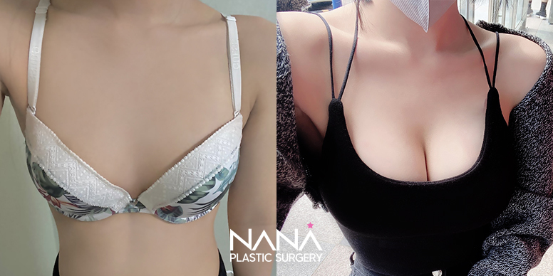 Before & After Before & After