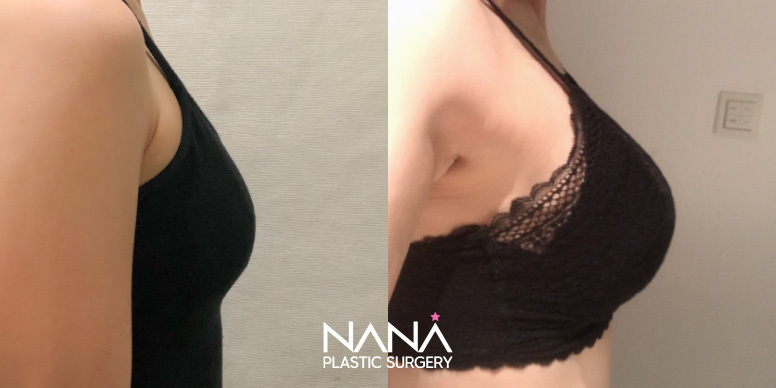 Before & After Before & After