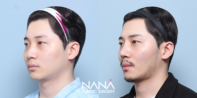 Before & After Before & After