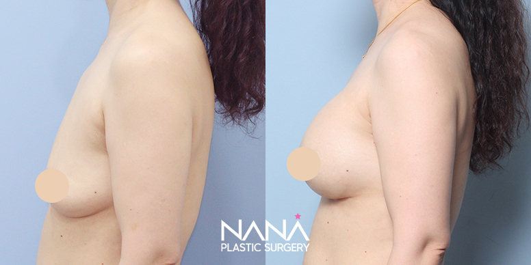 Before & After Before & After