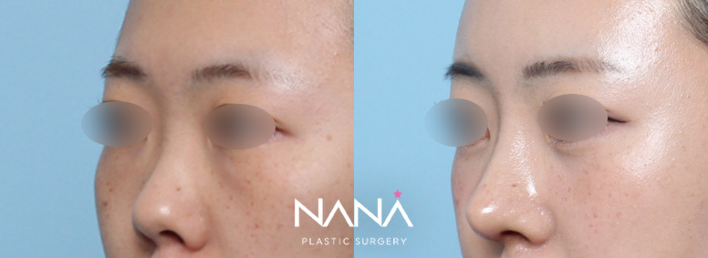 Before & After Before & After