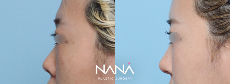 Before & After Before & After