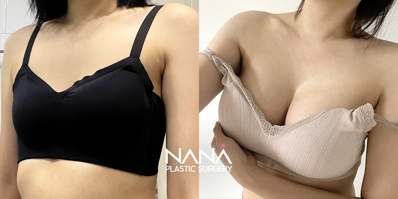 Before & After Before & After