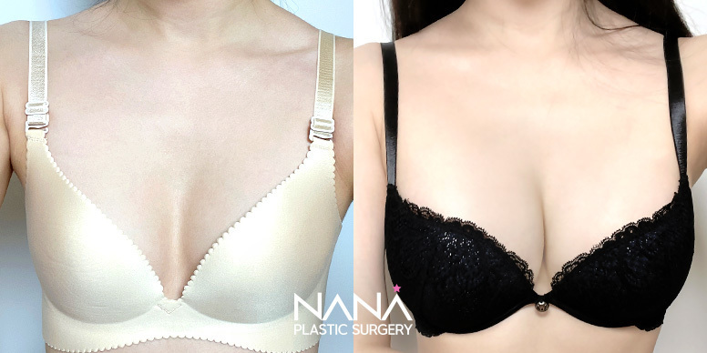 Before & After Before & After