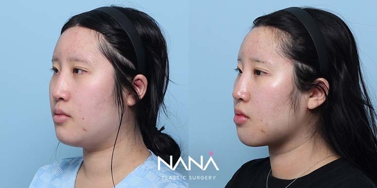 Before & After Before & After
