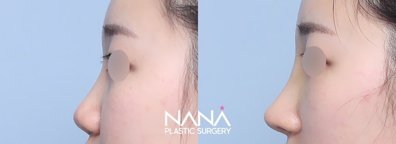 Before & After Before & After