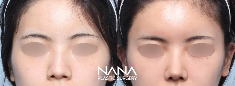 Before & After Before & After