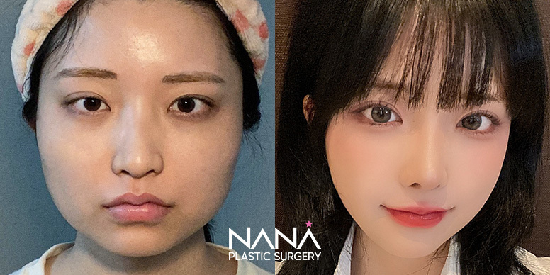 Before & After Before & After