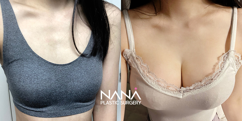 Before & After Before & After