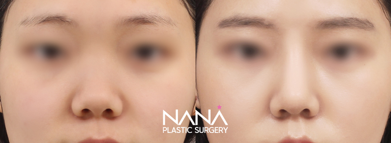 Before & After Before & After