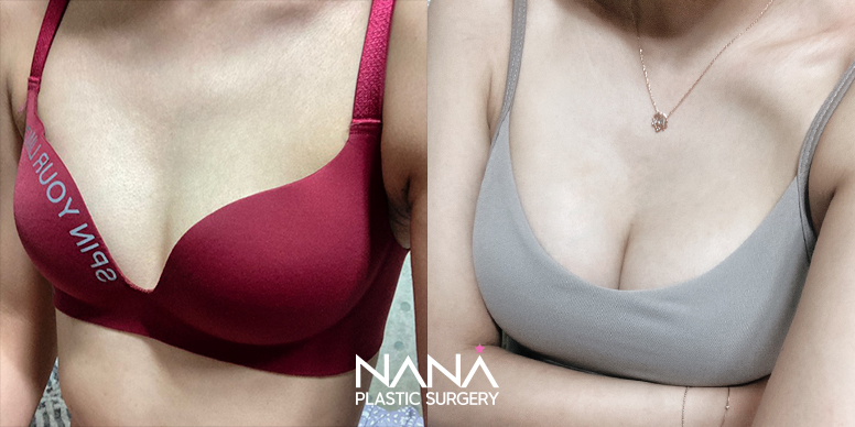 Before & After Before & After