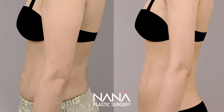 Before & After Before & After