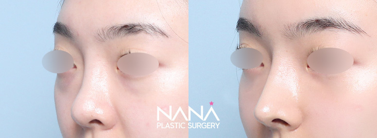 Before & After Before & After