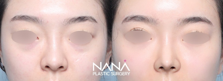 Before & After Before & After