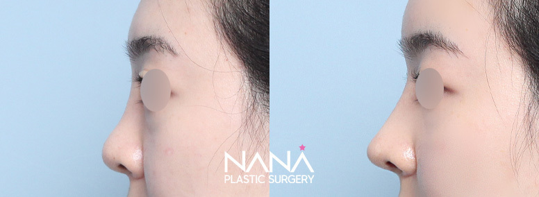 Before & After Before & After