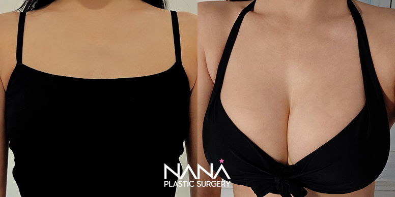 Before & After Before & After