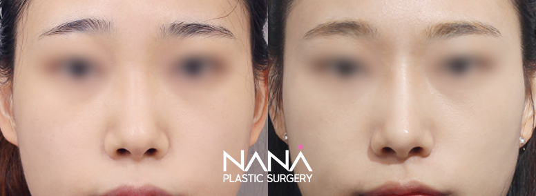 Before & After Before & After