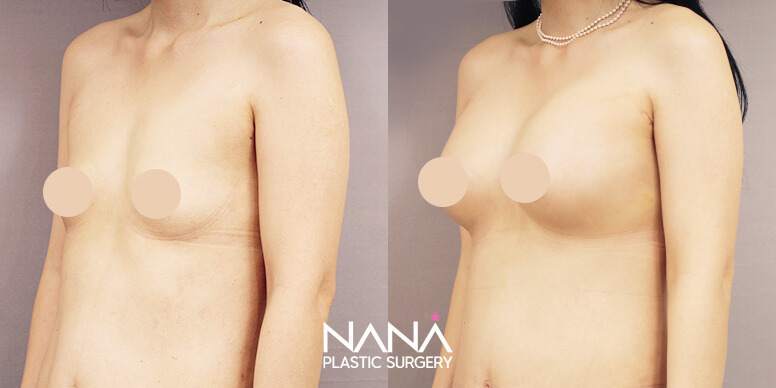 Before & After Before & After