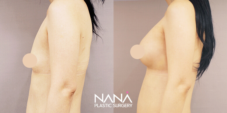 Before & After Before & After