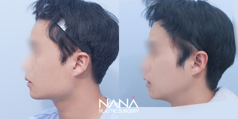 Before & After Before & After