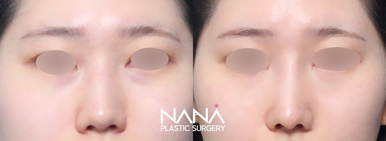 Before & After Before & After