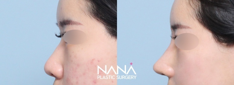 Before & After Before & After