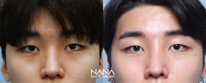 症例写真 症例写真