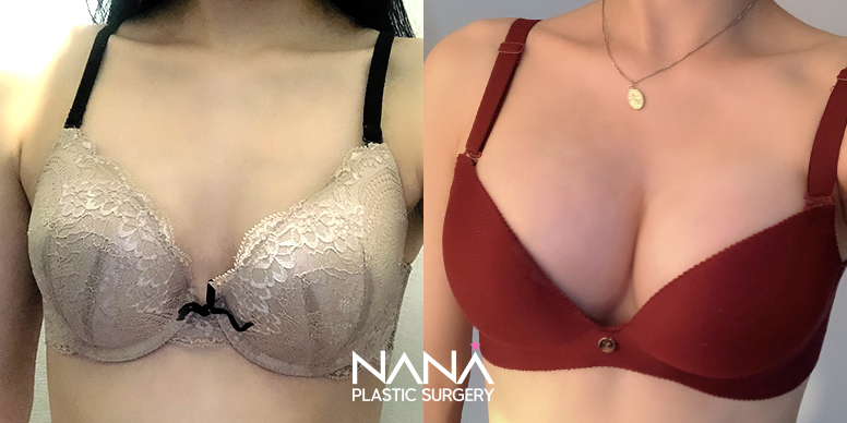 Before & After Before & After