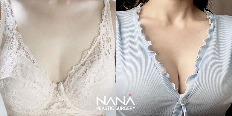 Before & After Before & After