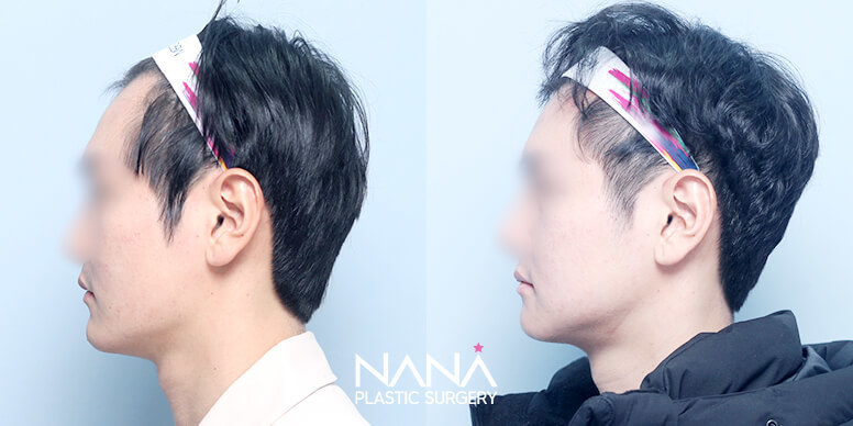 Before & After Before & After