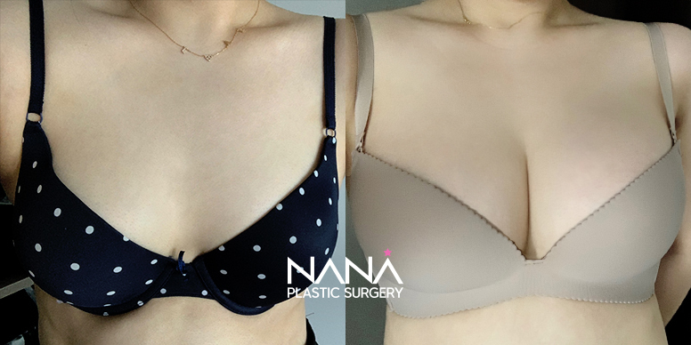 Before & After Before & After