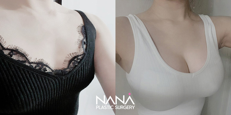 Before & After Before & After