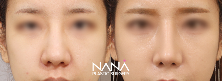 Before & After Before & After