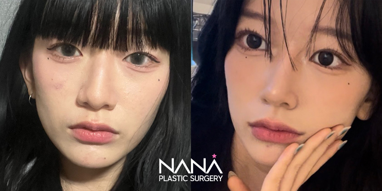 Before & After Before & After