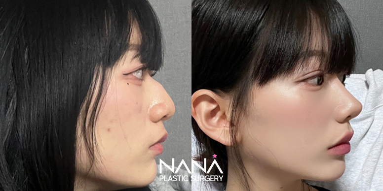 Before & After Before & After