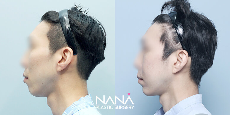 Before & After Before & After