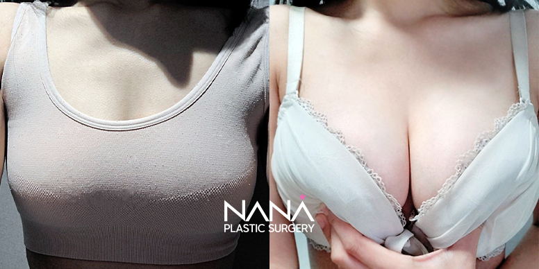 Before & After Before & After
