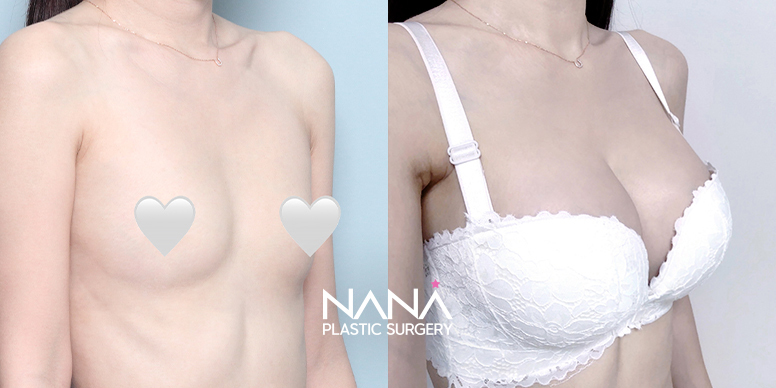 Before & After Before & After