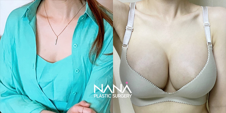 Before & After Before & After