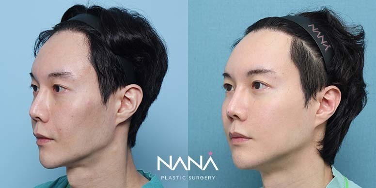 Before & After Before & After